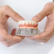 Стоматологическая клиника Зубы за один день фотография 16