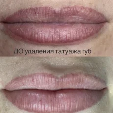 Студия перманентного макияжа Анны Кашниковой фотография 1