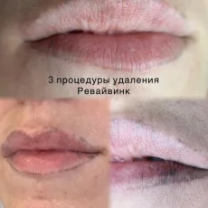 Студия перманентного макияжа Анны Кашниковой фотография 6