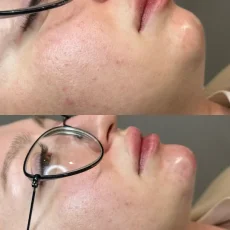Студия косметологии Future Face фотография 5