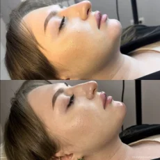 Студия косметологии Future Face фотография 19