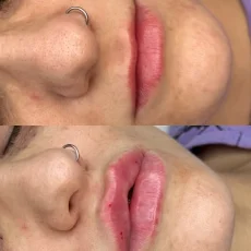 Студия косметологии Future Face фотография 14