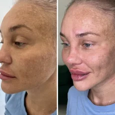 Студия косметологии Future Face фотография 8